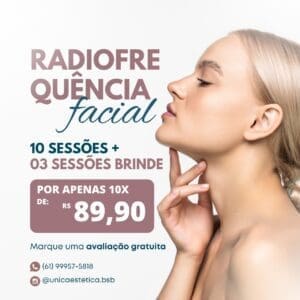 Radiofrequência
