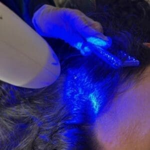 Ledterapia Capilar